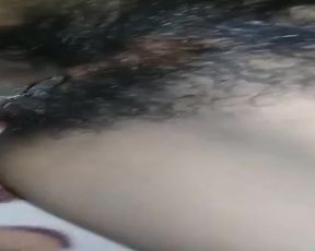 Hairy 27